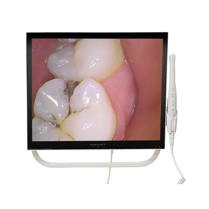 Magenta YFHD-D Cámara intraoral dental 1/4 sony CCD Monitor de 17 pulgadas y brazo de soporte