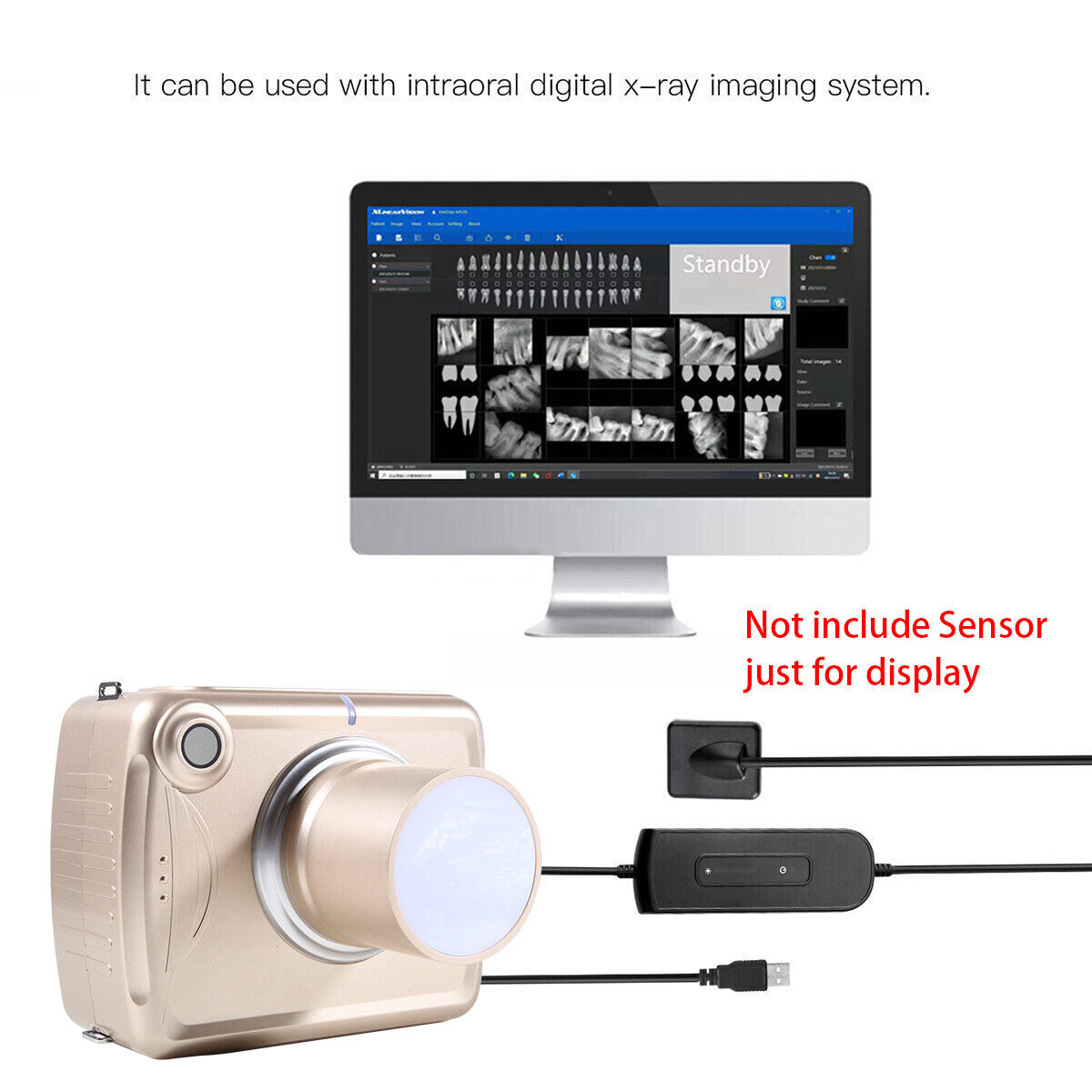 Máquina de rayos X dental portátil digital Sistema de imágenes de alta frecuencia