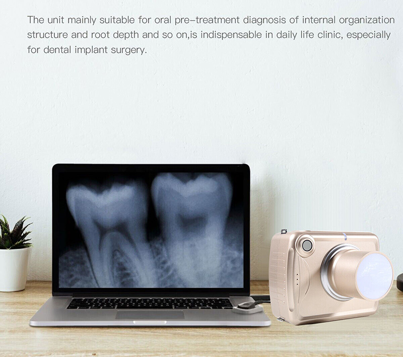 Máquina de rayos X dental portátil digital Sistema de imágenes de alta frecuencia