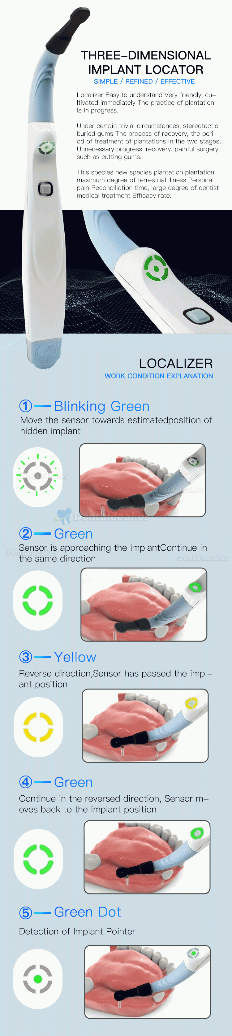 Localizador de implantes dentales detector de implantes sensor giratorio tridimensional