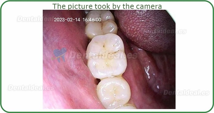 Cámara intraoral oral WiFi inalámbrica dental MD-100 para teléfono móvil y iPad