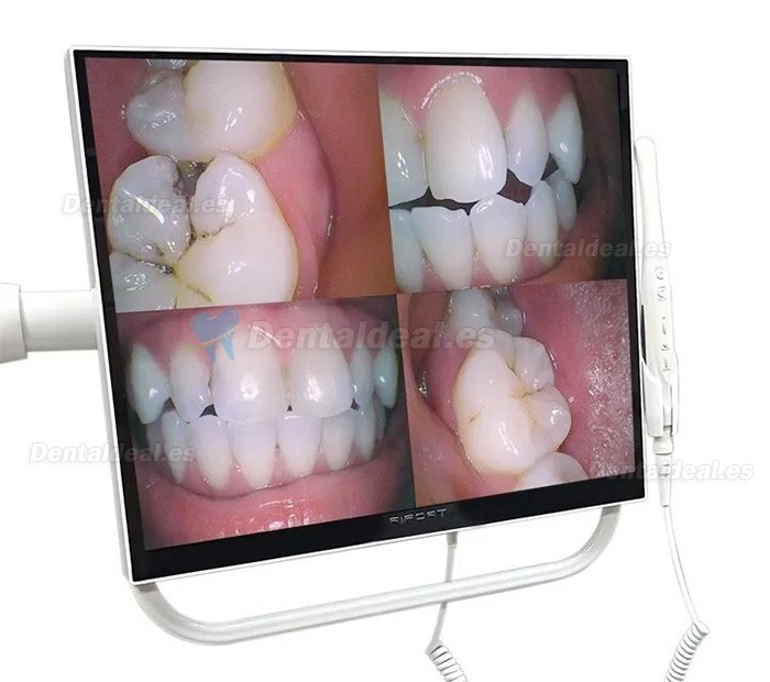 Magenta YFHD-D Cámara intraoral dental 1/4 sony CCD Monitor de 17 pulgadas y brazo de soporte