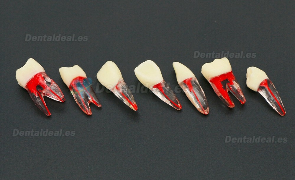 10Pcs Modelo de dientes Endodoncia para práctica de conducto radicular dental