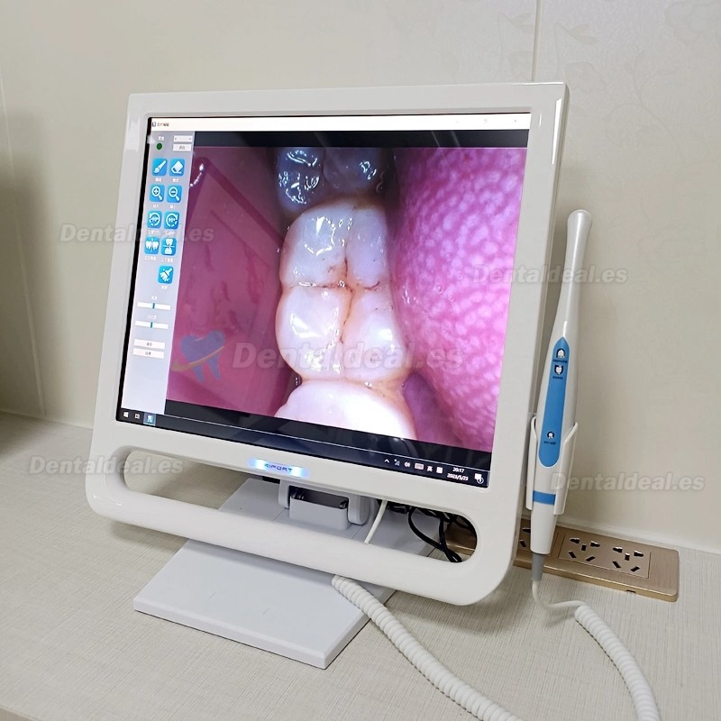 YF-1700P+ Cámara intraoral dental pantalla táctil de 17 pulgadas para unidad dental con soporte