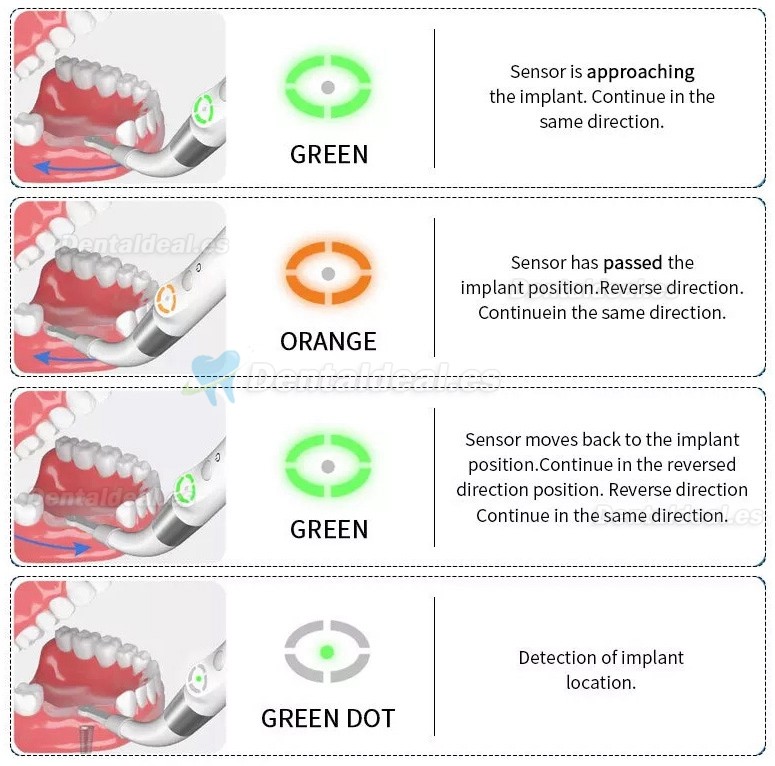 YAHOPE iD1 Detector de implantes dentales localizador de pilares de implantes sensor giratorio de 360°