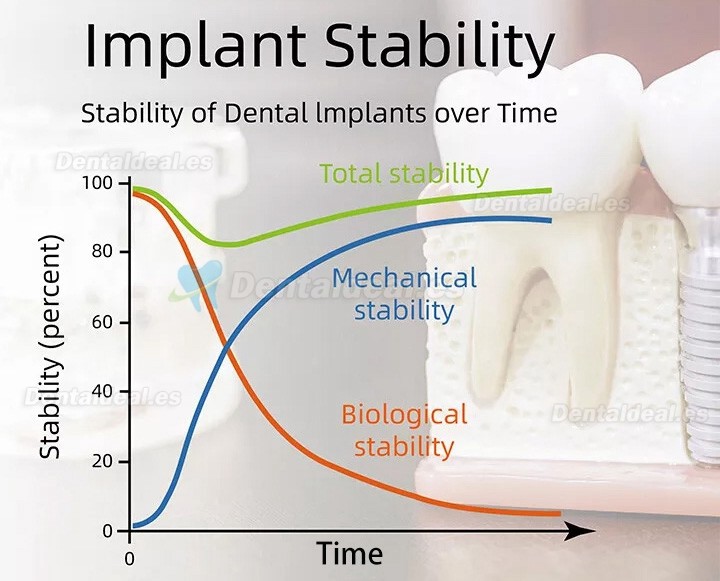 YAHOPE iCHECK Monitor de estabilidad implantaria comprobador estabilidad implantes medidor de estabilidad