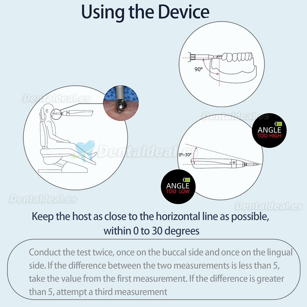 YAHOPE iCHECK Monitor de estabilidad implantaria comprobador estabilidad implantes medidor de estabilidad