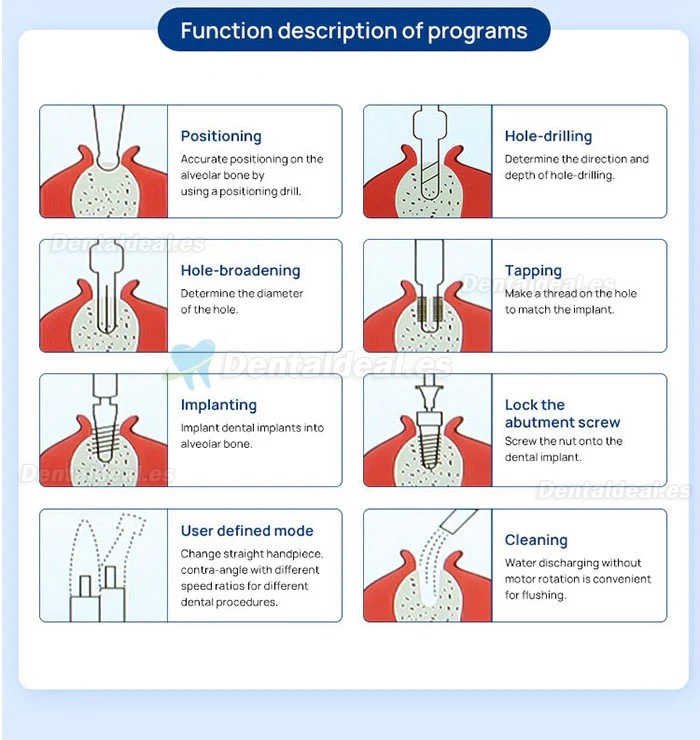 YAHOPE IMPLANT Surg Motor sin escobillas quirúrgico para implantes dentales con contraángulo LED 20:1